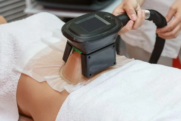 Image of person having fat freezing treatment to help weight gain Wakefield