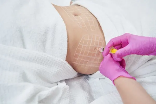 image of fat dissolving injections on love handles to help combat weight gain Wakefield