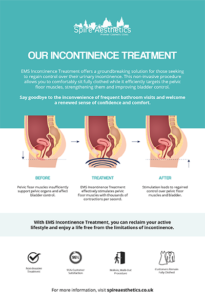 image to show how EMS treatment works for female urinary incontinence Wakefield