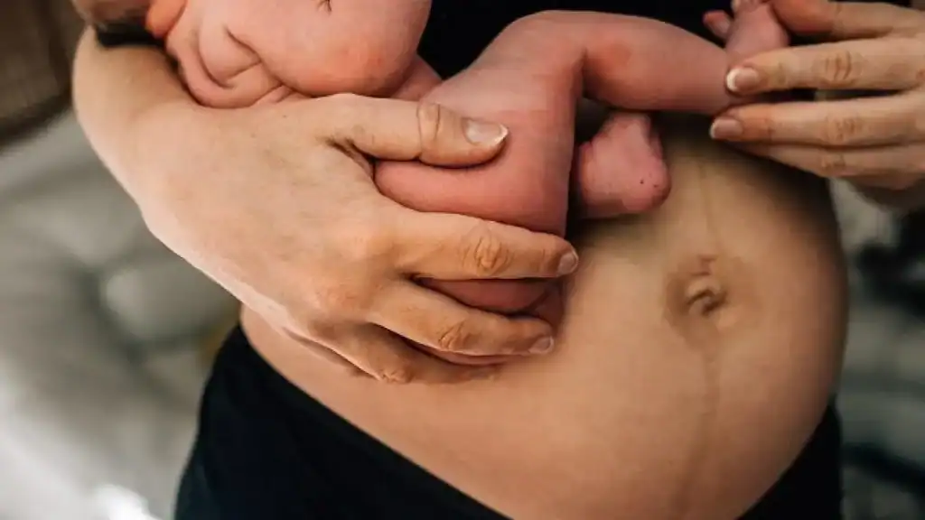 Why Is My Stomach Still Big After Pregnancy Wakefield?
